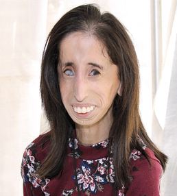 Lizzie Velasquez: Child of Camelot - Kim Michael